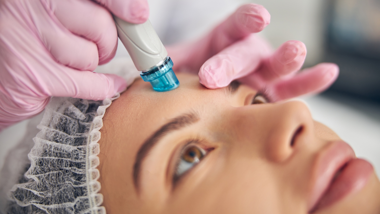 Hydrofacial x Acid Peel